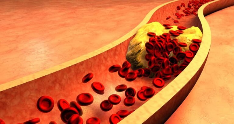 Consumir pistache regularmente pode diminuir o colesterol LDL e prevenir doenças cardíacas