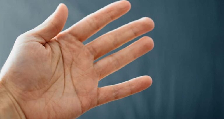 o que é esclerodermia e como identificar