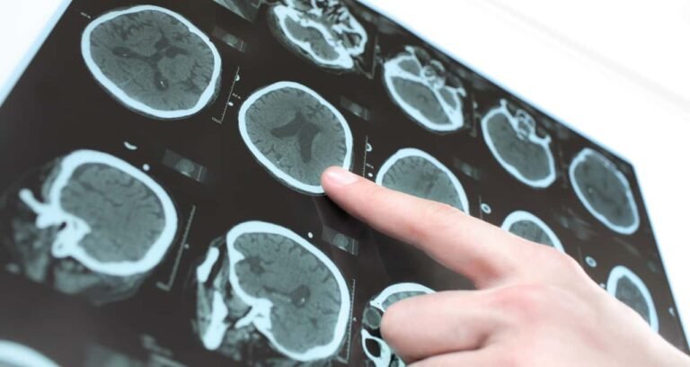 Por que esta bebida ajuda a prevenir o Parkinson?