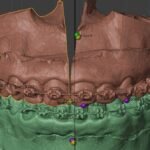 Hospital de Base é referência em cirurgias bucomaxilofaciais de alta complexidade 