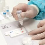 DF inova para ampliar testagem rápida para infecções sexualmente transmissíveis