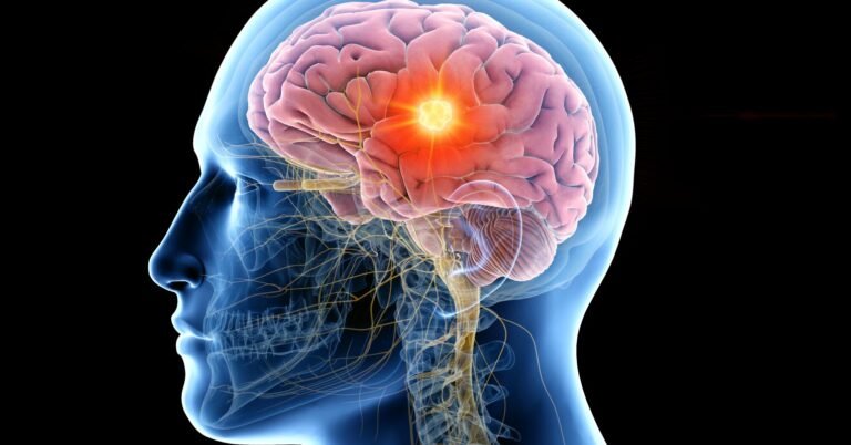 Quatro passos para a saúde do cérebro, de acordo com um neurologista