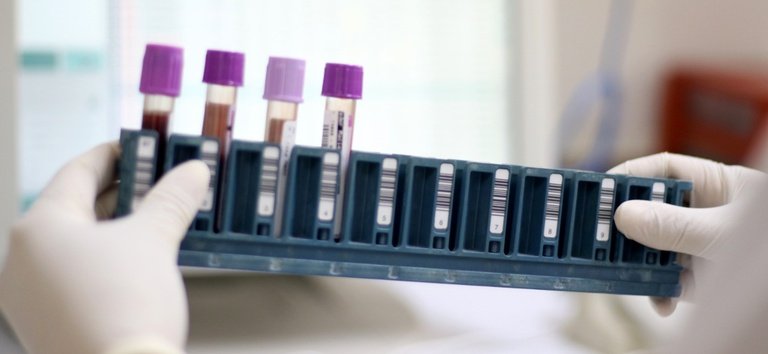 Mato Grosso já conta com pontos de coleta para exame genético de doenças raras no SUS — Ministério da Saúde