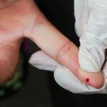 Ministério incorpora teste rápido para diagnóstico de dengue ao SUS