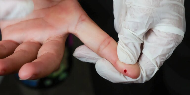 Ministério incorpora teste rápido para diagnóstico de dengue ao SUS