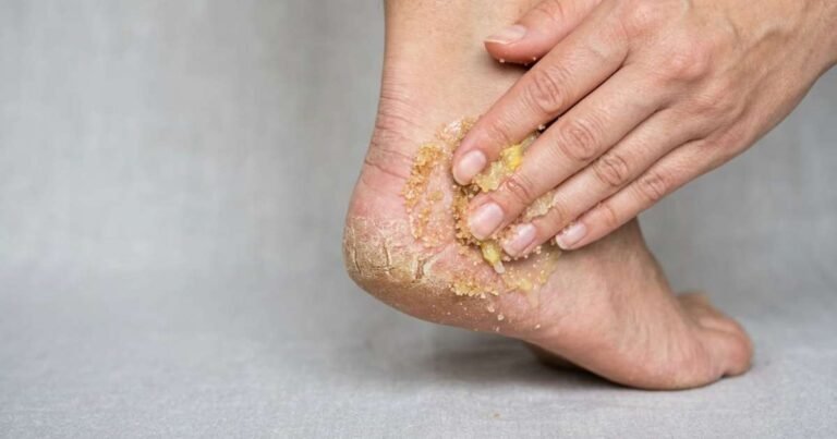 por que é recomendado e quando é melhor fazê-lo