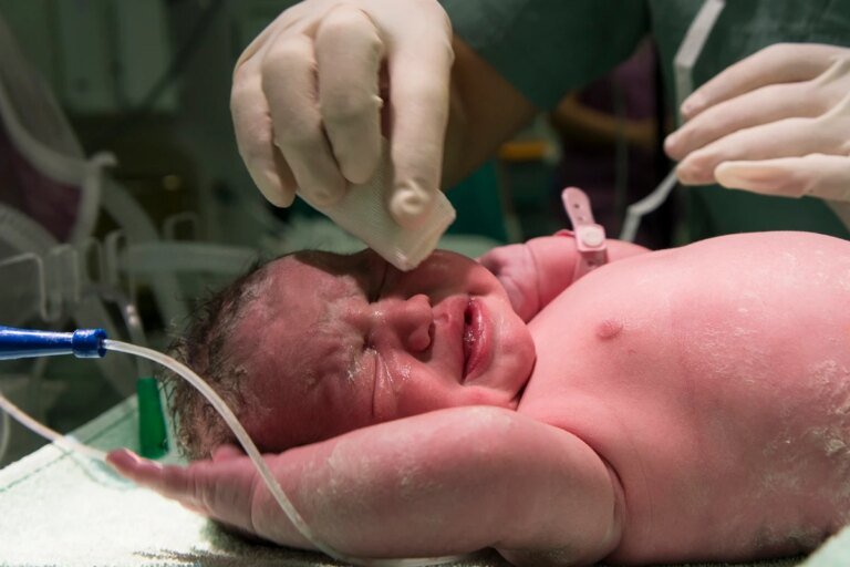 Herpes congênita faz bebês ficarem mais tempo na UTI, aponta estudo