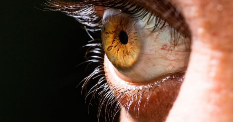 Doença do olho seco e outras de superfície ocular contam com nova tecnologia para tratamento