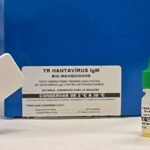 Brasil não tem circulação do hantavírus que causou surto em navio