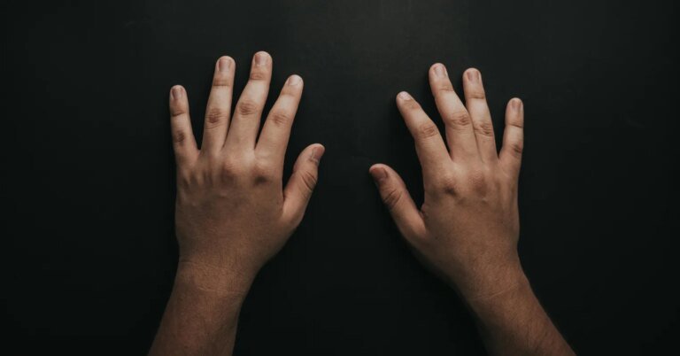 A lateralidade afeta os acidentes de trabalho?