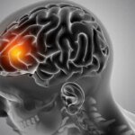 Neurologista comenta aumento de casos de AVC em jovens