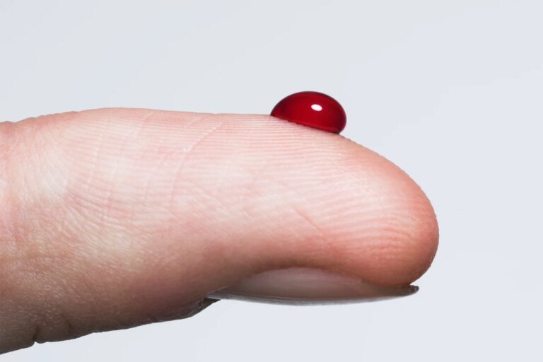 Diabetes pode dar sinais na pele, nos olhos e até nos pés. Saiba quais