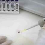 Exames descartam vírus ebola em pacientes com suspeita no Rio e em SP