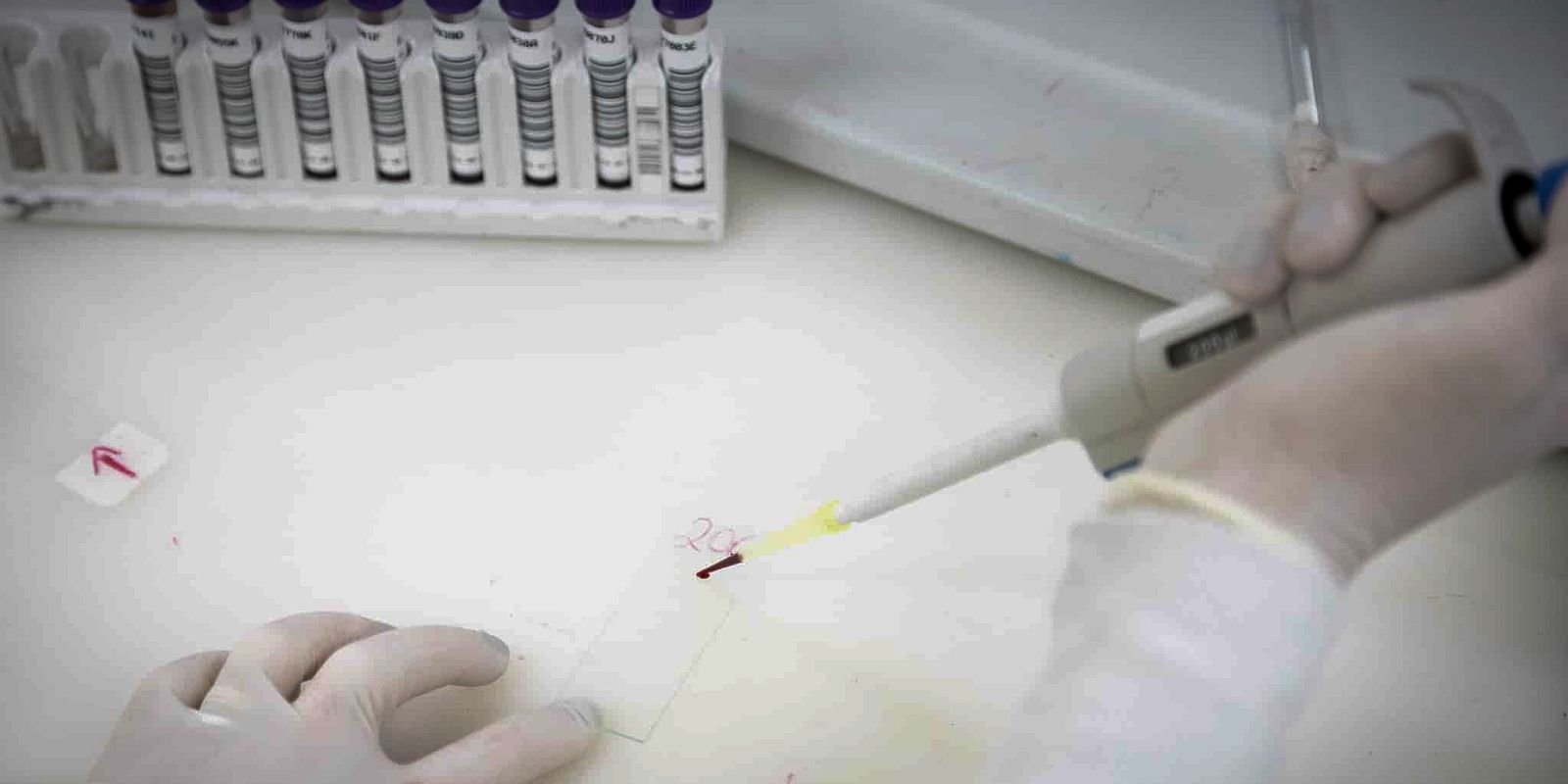 Exames descartam vírus ebola em pacientes com suspeita no Rio e em SP