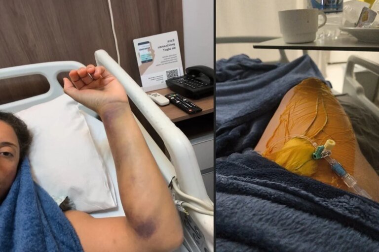 Brasiliense tem tromboembolismo pulmonar após viagem curta de avião