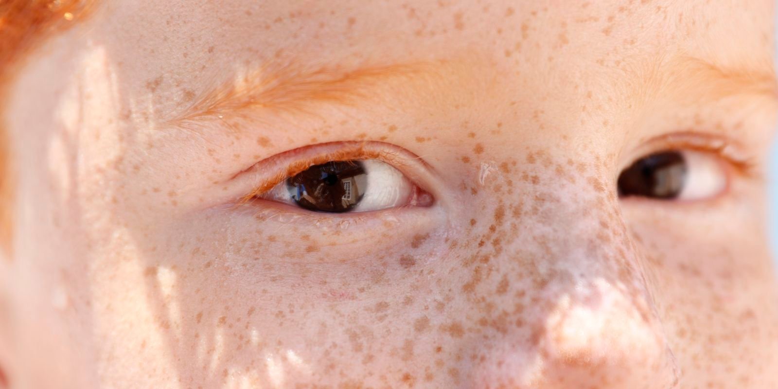 Dia da Saúde Ocular chama atenção para doenças que afetam a visão
