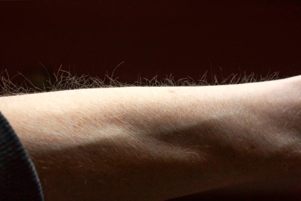 Pelos da pele podem ajudar o corpo a detectar coceira, sugere estudo
