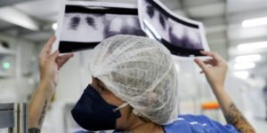 Número de casos de SRAG segue em queda na maior parte do país