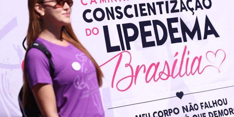 Lipedema: doença crônica vai além da questão estética
